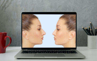 Morphing nasale nella Rinoplastica!