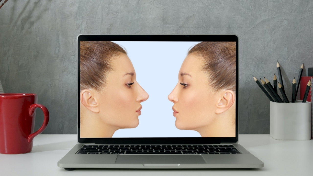 Dr Saverio Fania Morphing nasale nella Rinoplastica!